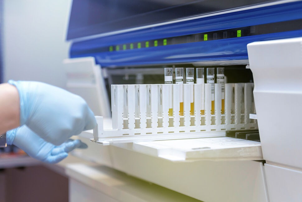 Technician Using Urine Analyzer In Lab